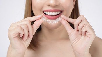 Invisalign