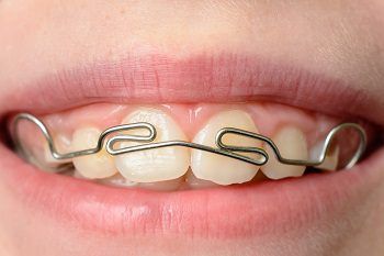 How to handle orthodontic emergencies?