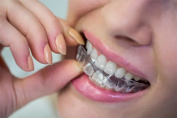 Broken Retainer
