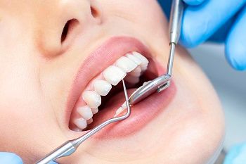 Orthodontic Force