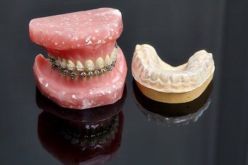 Invisalign